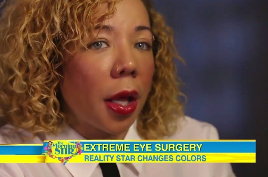 Tameka "Tiny" Harris Plastic Surgery Eyes